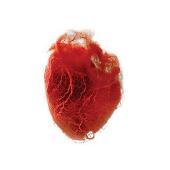 Love Is Simple [CD/DVD]