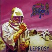 Leprosy