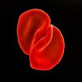 Scratch My Back [Special Edition]